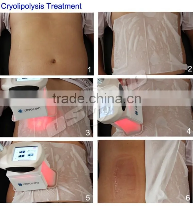 Wholesale 27x 34cm Cryo Pad Anti Freeze Cryolipolysis Antifreeze Membrane With Test Report