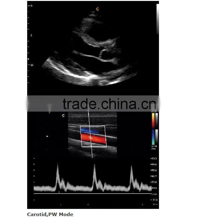 2016 new Portable Color Doppler(Optional 4D) for cardiac use