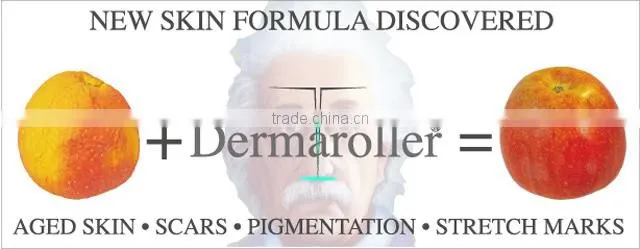 professional microneedle roller /magic anti ageing ,wrinkle removal,microneedle skin roller(CE approved)