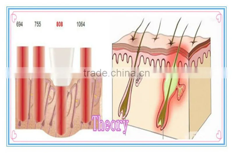 best machine wholesale price new design ipl shr hair removal laser