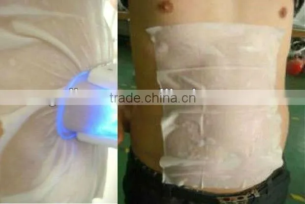 Anti-freeze membrance of cryo machine