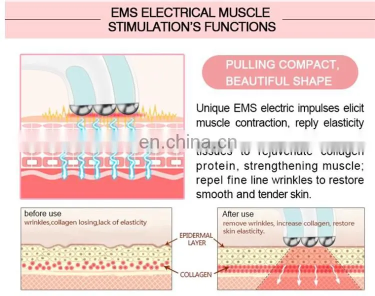 Professional Rechargeable EMS RF temperature control electroporation beauty salon equipment Japan beauty care tools
