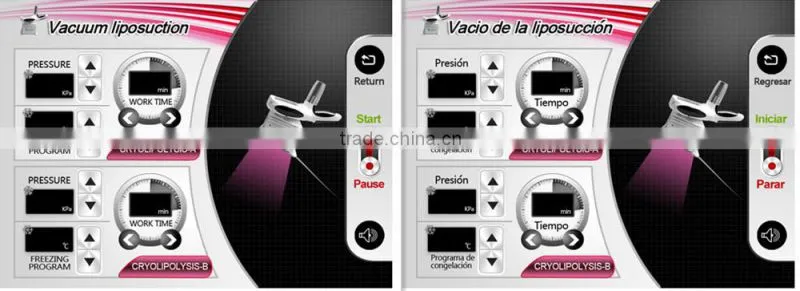 Promotion cryolipolyse machine vertical weight loss feature kryolipolyse