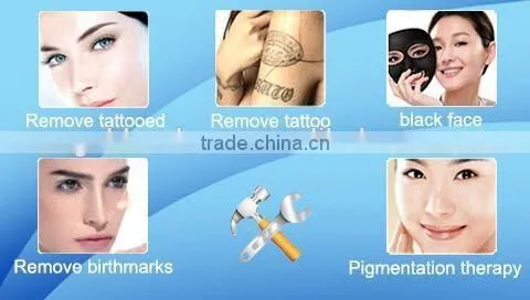 HOT!! tattoo removal machine without laser