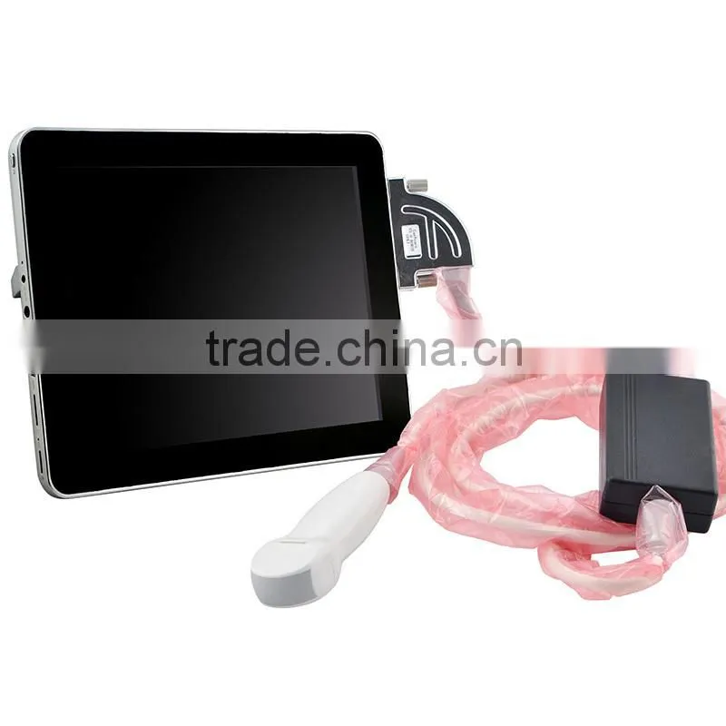Manufacturer wholesale pc ipad ultrasound scanner China good price mini ultrasound scan machine