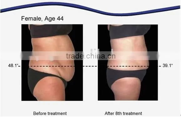 GS86 cavitation rf slimming machine body shaping machine