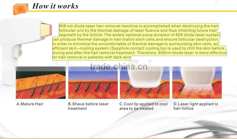 Powerful!!!808nm professional diode laser hair removal for dark skin