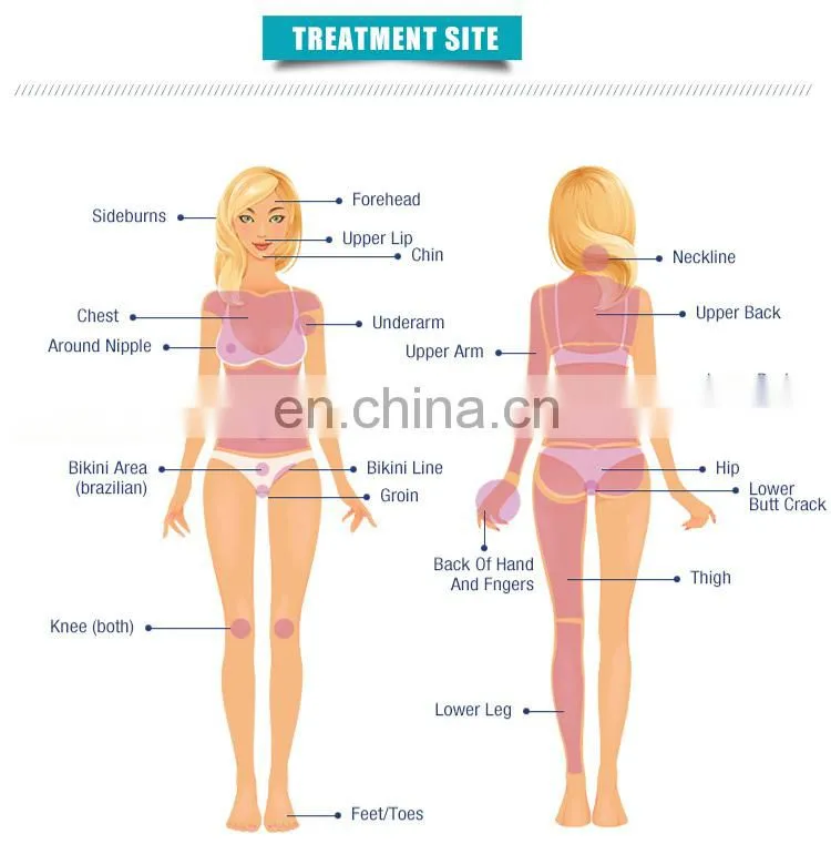 Factory price 4 in 1 korea shr+ipl+rf hair removal tattoo removal nd yag laser 532nm 1064nm 1032nm skin lift beauty machine