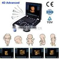 3D Color Doppler Ultrasound Machine with touch screen with competitive price MSLCU22-N