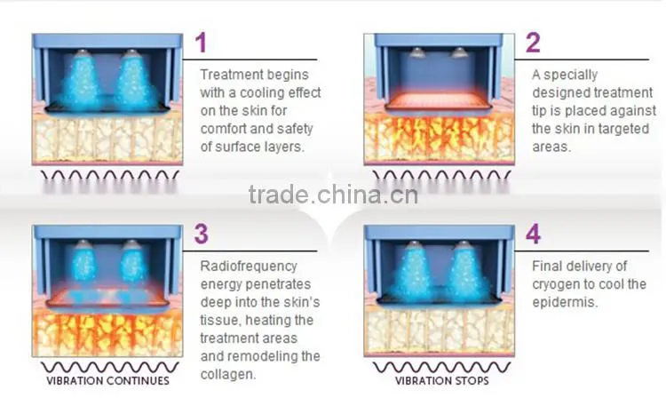 Portable amageing effective best home rf skin tightening face lifting machine