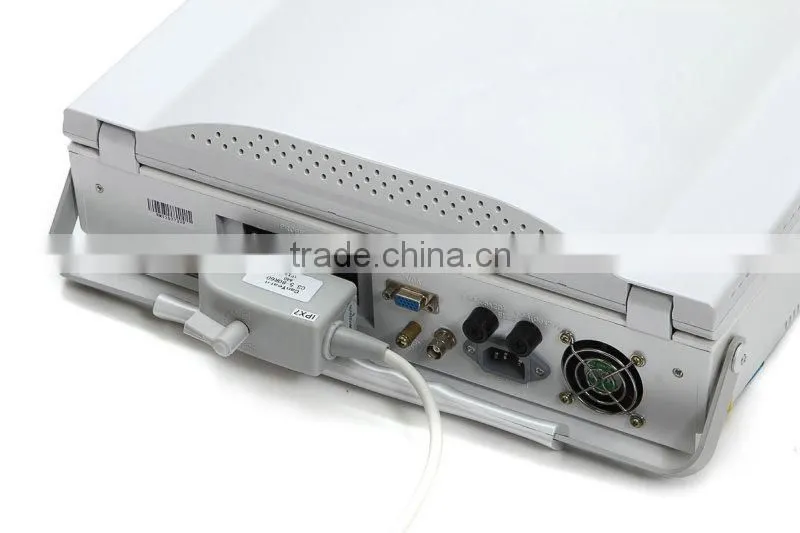 High frequency linear probe Micro-convex probe convex probe Laptop Ultrasound Scanner