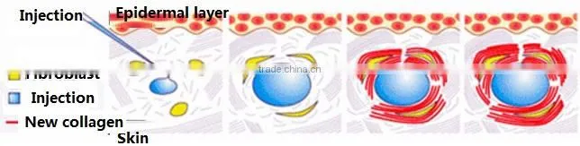 Water Mesotherapy injection machine