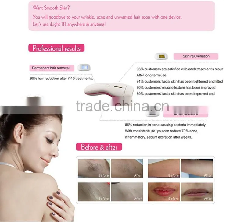 DEESS home laser hair removal face anti acne whitening cream skin whitening face cream for pigmentation