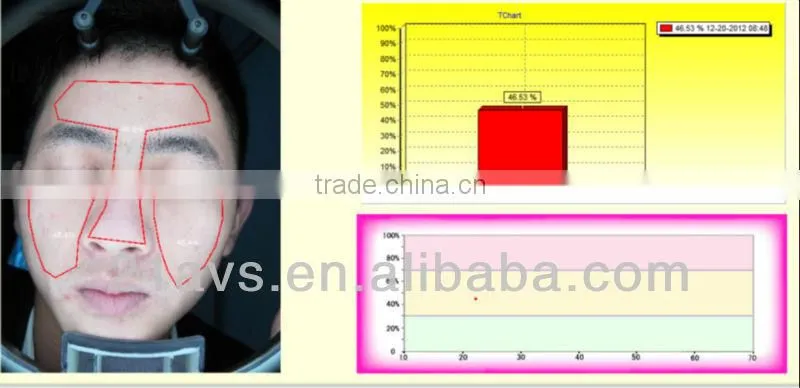 Guangzhou facial skin analysis machine