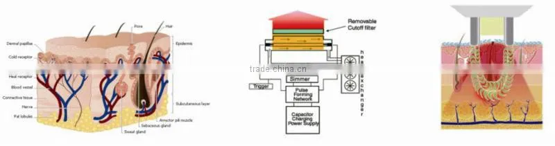 Chinese Apolo Med CE& ISO approved beauty machine elight rf ipl equipment