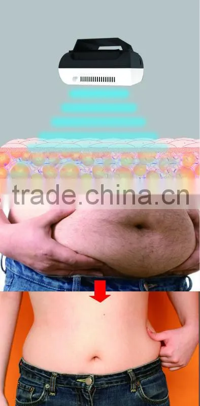2014 cryotherapy Mini Cryolipolysis machine cryolipolysis machine equipment for home use