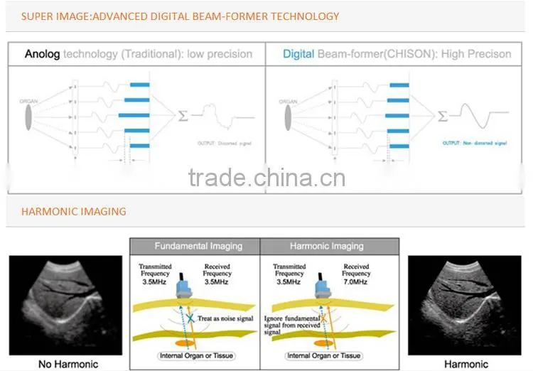 MCB-8500 High definition Black and White Ultrasound Machine best price for portable echographe doppler mindray