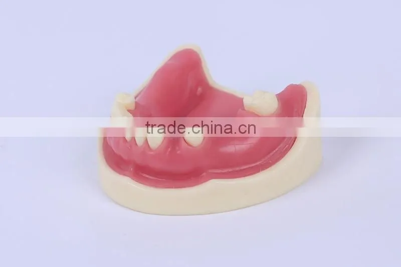 Trade Assurance Hot Dental Implant System CE Approved Dental Implant Model