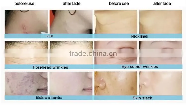 Wholesale Soft Facial Cleansing Brush Washing Face Silicone Cleansing Brush
