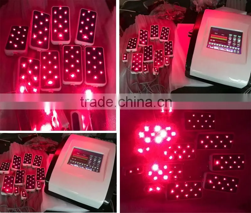 2016 Portable lipo laser machine with factory price