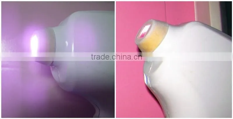 Hot sale powerful 808nm Diode laser hair removal machine