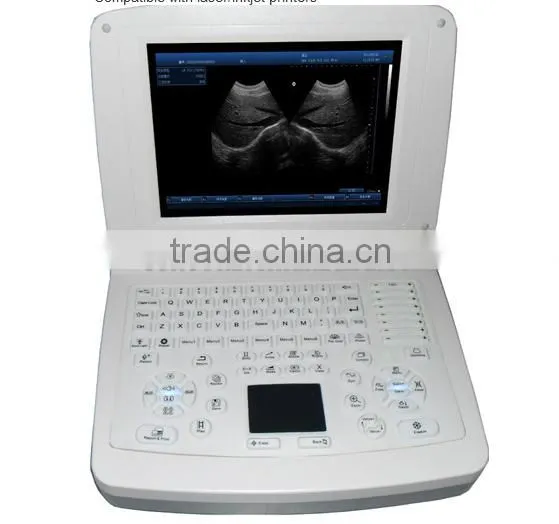 Sonostar good quality handheld portable vet ultrasound scanner pig veterinary ultrasound V10(SS-10V )