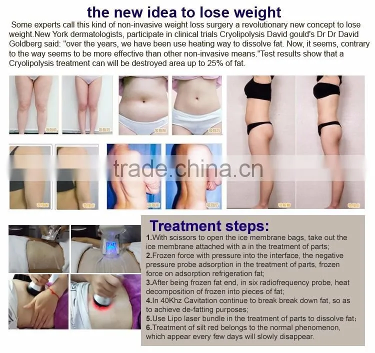 OEM ODM multifunctional RF vacuum fat freezing slimming machine with 40K cavitation llipoo laseer