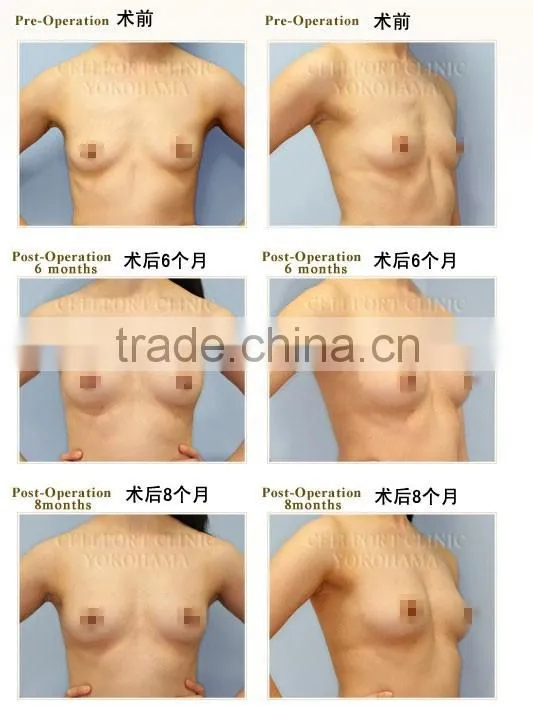 Professional vibrator breast enlargement with high quality