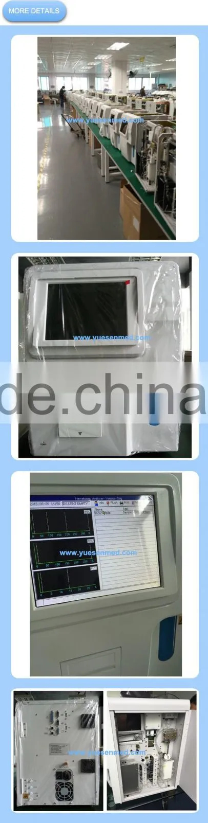 portable auto hematology analyzer for sale