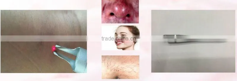 distributor low price ! 980nm spider vein removal machine vascular remover 980 varicose vein laser