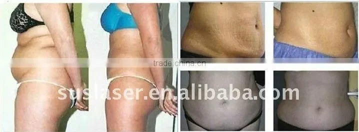 Hot!! Portable fat cavitation slimming machine S50(CE&ISO)cavitation rf tripolar slimming machine