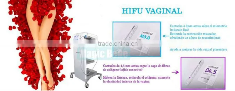 Easy to use hifu vaginal tighten for woman