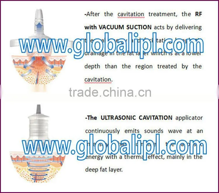 body slimming equipment 635nm diode laser fat melting with high quality