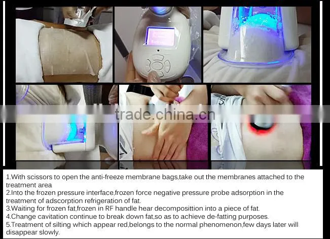 Fast fat reduction Hot popular multifuncion best effective freezing fat reductional machine