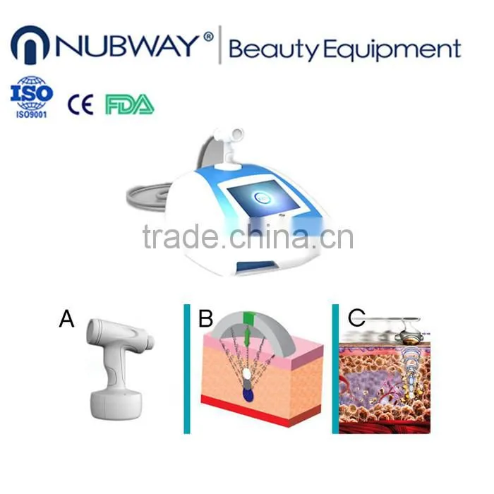 vacuum liposuction,liposuction ultrasonic,new non invasive liposuction