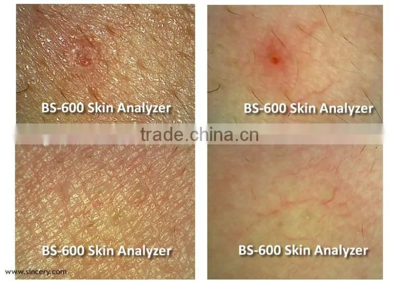 Portable high quality skin scanner/Mini skin and hair scanner