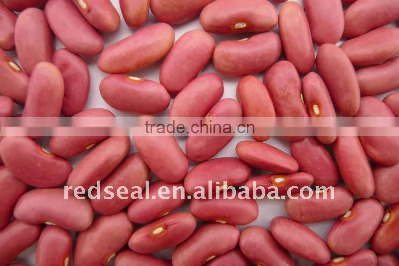 Round shape light speckled kidney beans