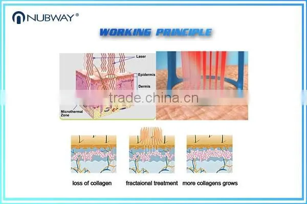 High power 40W laser scars wrinkles removal fractional co2 laser co2 fractional