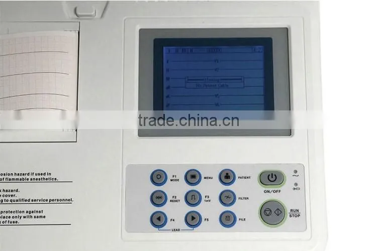 Beijing High resolution thermal printing system 3.8 inch LCD Three channel digital ECG machine for sale