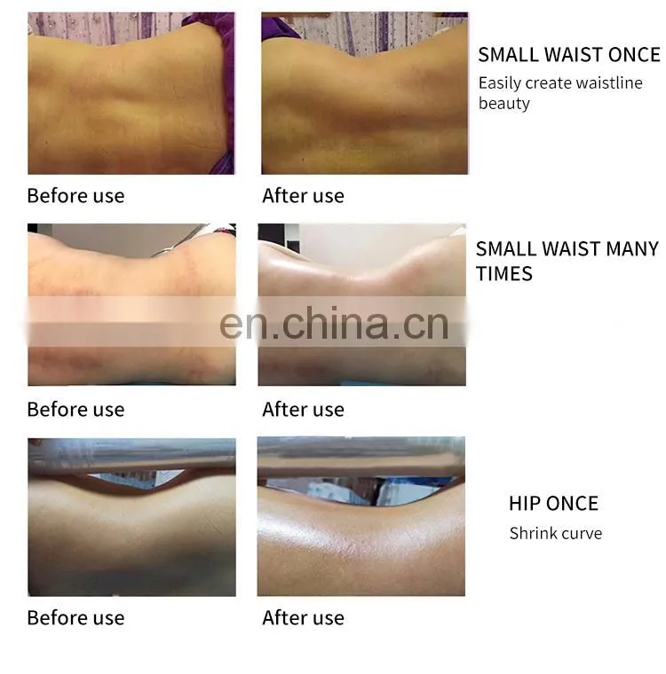 3 IN 1 Body Shaping Machine Microwave+Microcurrent+Vacuum Negative Pressure Weight Loss Device Body Physiotherapy Massage