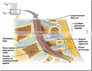 medical devices/spinal needle/qunicke chiba type and pencil point type spinal needle