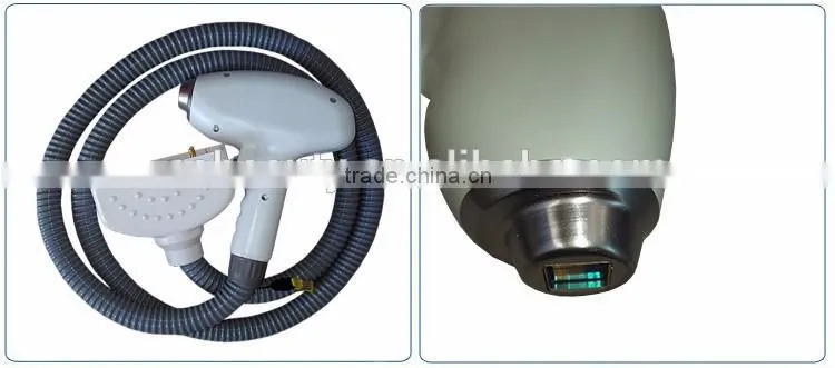 808nm diode laser hair removal machine diode laser for hair removal