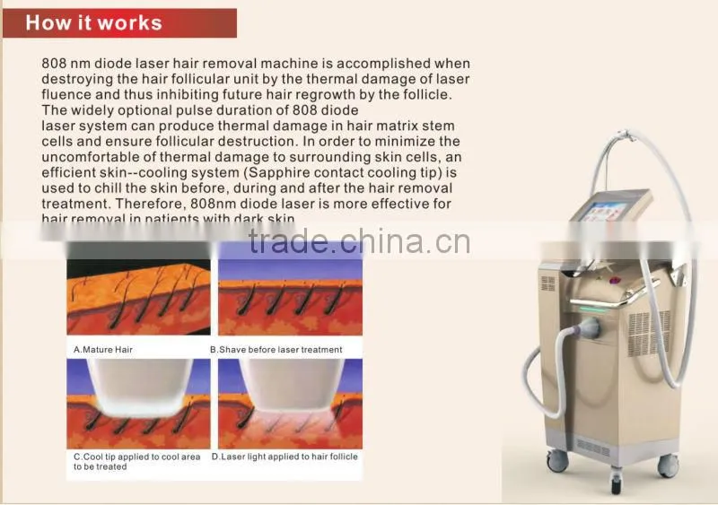2014 Newest And Fashional Micro Channel 808nm Diode Laser Machine-DIOD-III