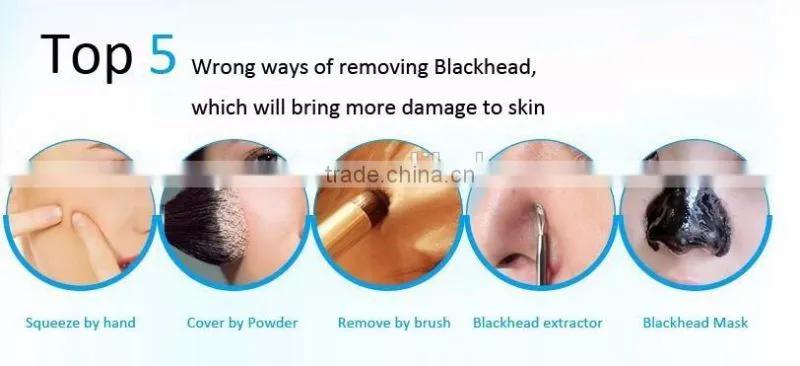 2017 Most Popular Blackhead Remover vacuum blackhead remover