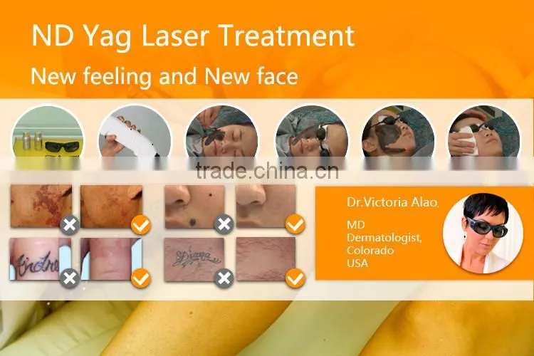 q switched nd yag laser treatment Remove tattoo / eyebrow tattoo / nevus laser machine