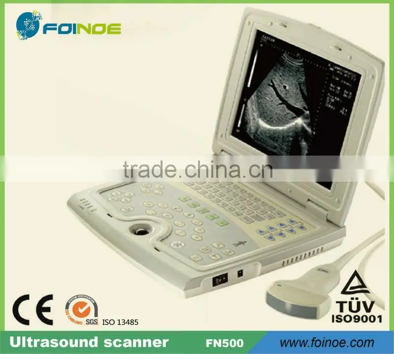FN660 CE approved digital ultrasonic diagnostic imaging system
