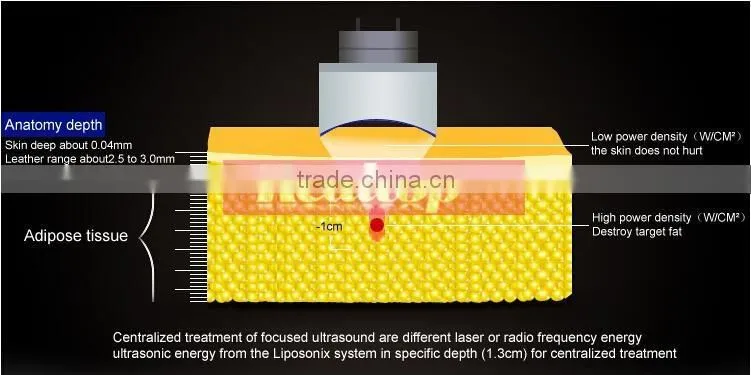 Professional ultrasounic hifu body shape machine ultrashape liposonic hifu slimming machine on sale