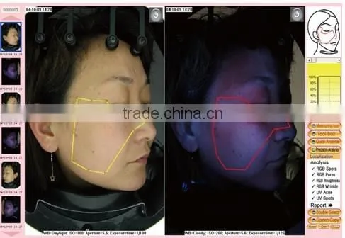 Skin Analyzer Type Portable Digital Skin analyzer