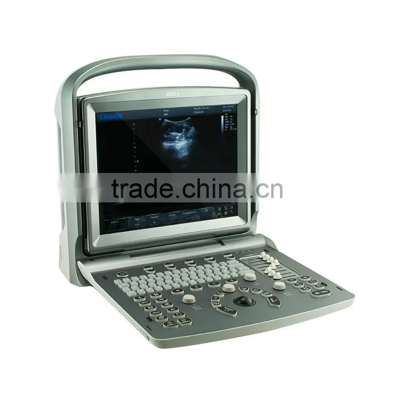 China cheap price USB portable laptop color doppler ultrasound scanner for pregnancy scanner ultrasound