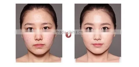High Quality Korea Aloe Mineral Waterproof Face Makeup Powder,Concealer Pressed Powder Foundation